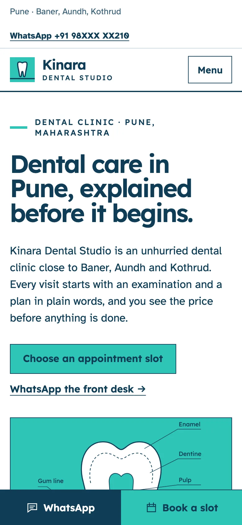 Dental clinics demo website on a phone