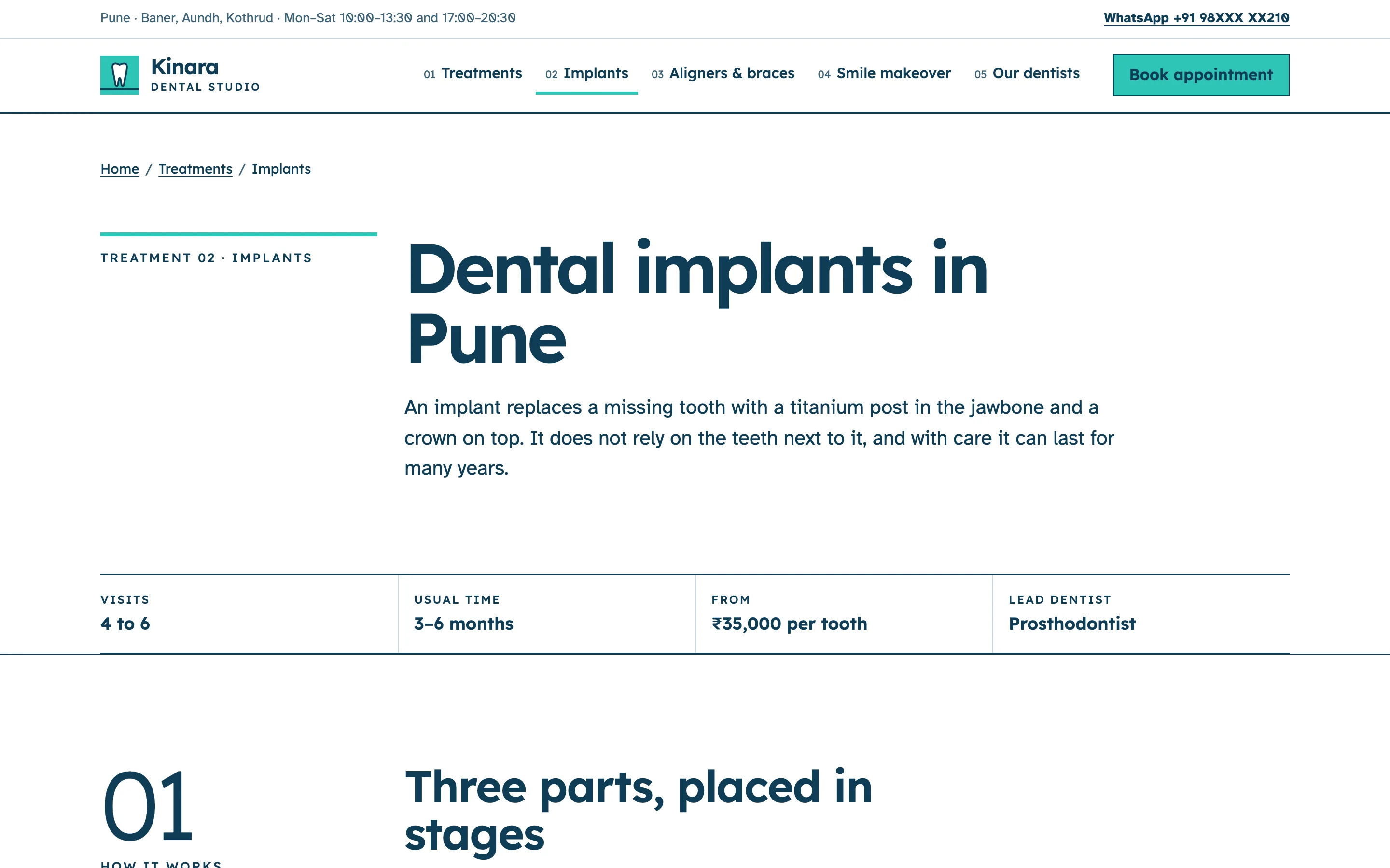 Dental clinics demo — Implants